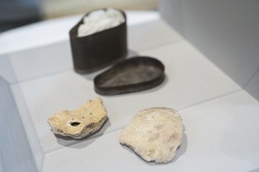 Ossos ser&atilde;o analisados