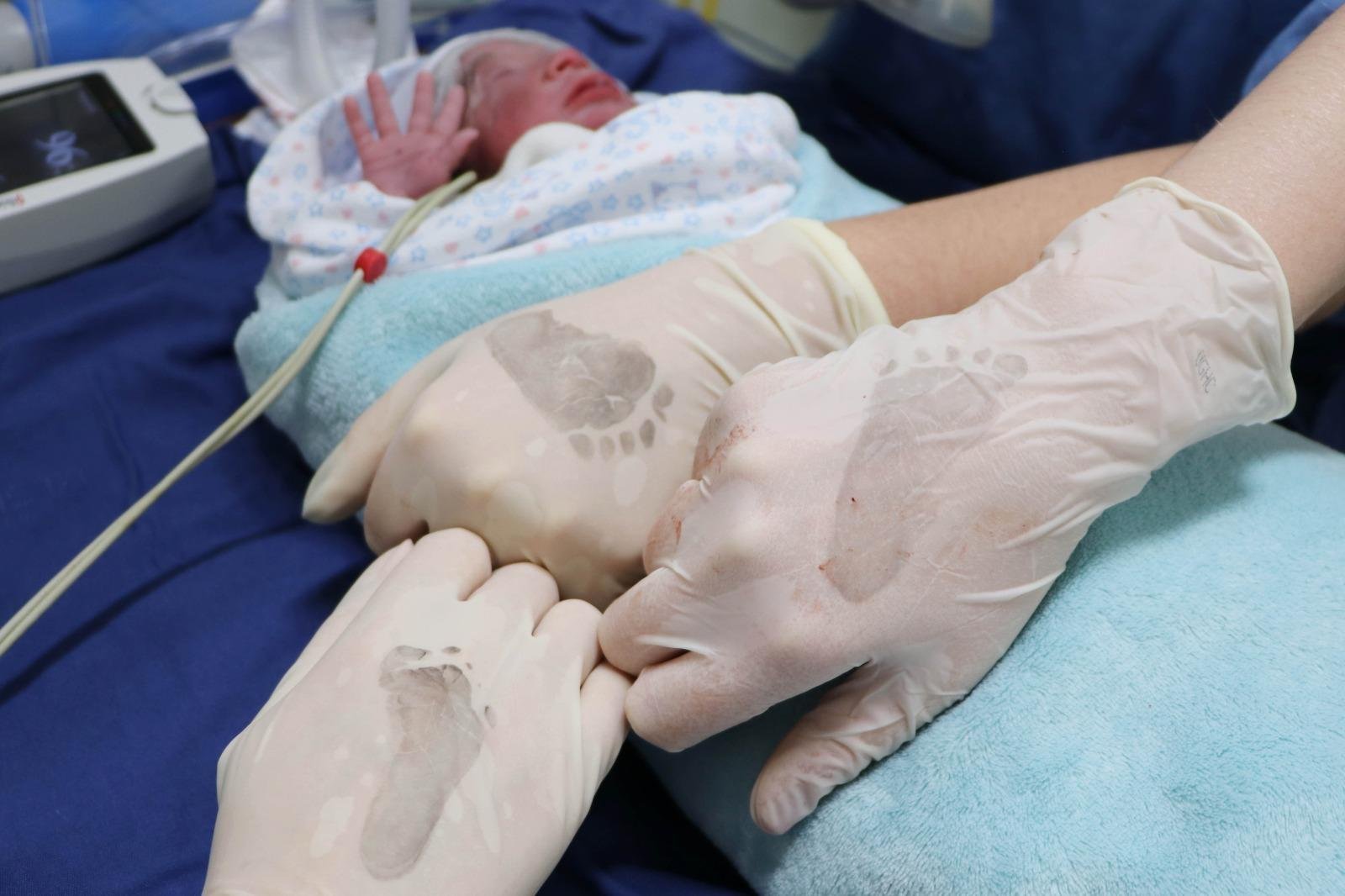 Como s&atilde;o prematuros, os trig&ecirc;meos Asher, Ayla e Aym&ecirc; precisam passar um per&iacute;odo na UTI Neonatal antes da alta m&eacute;dica