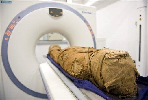 Eg&iacute;pcios dos fara&oacute;s j&aacute; tinham problemas cardiovasculares