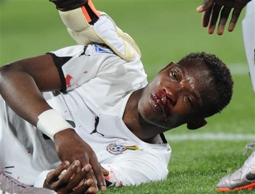 Defensor de Gana, John Paintsil, sangra ap&oacute;s choque com o atacante australiano, Josh Kennedy