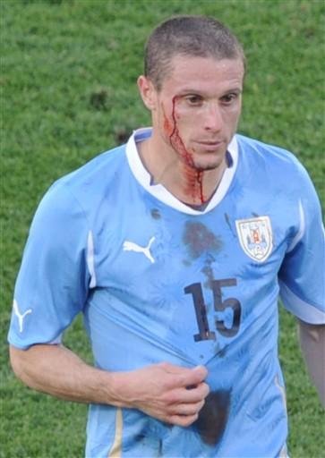 O meia uruguaio, Diego Perez, ap&oacute;s cabeceio, sofre um corte no supercilio