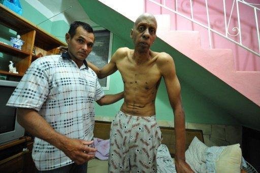 Dissidente cubano interrompe 135 dias de greve de fome