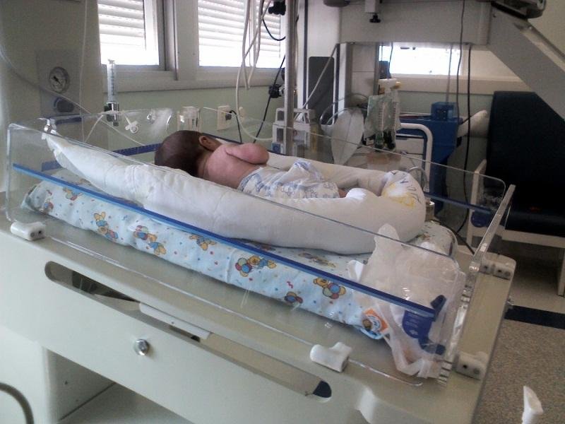 Menino tem 50 cm e pesa 2,7 kg