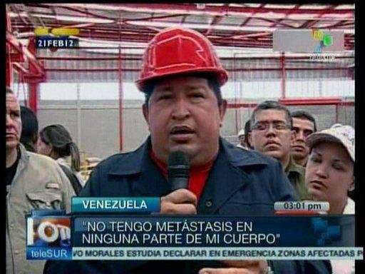 Cirurgia de Ch&aacute;vez &eacute; inadi&aacute;vel, conforme ele
