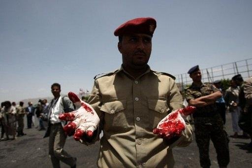 Centenas de soldados se feriram em ato ocorrido em Sanaa
