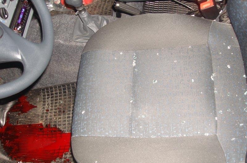 Mesmo ferido, motorista de carro alvejado conduziu dirigir at&eacute; o hospital