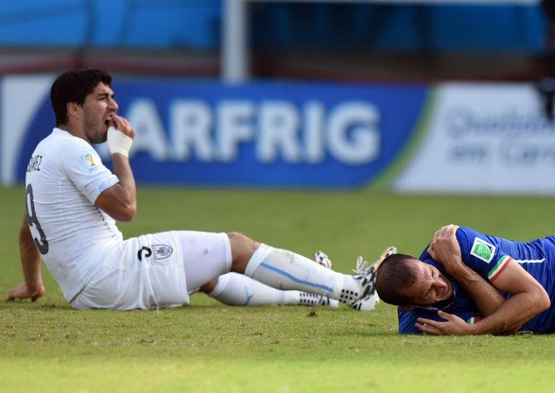 Uruguai defende que n&atilde;o h&aacute; prova de mordida de Su&aacute;rez em Chiellini