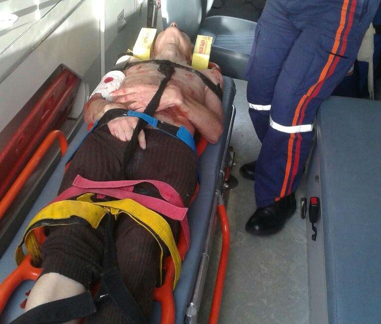 Homem levou tiro no bra&ccedil;o e na perna