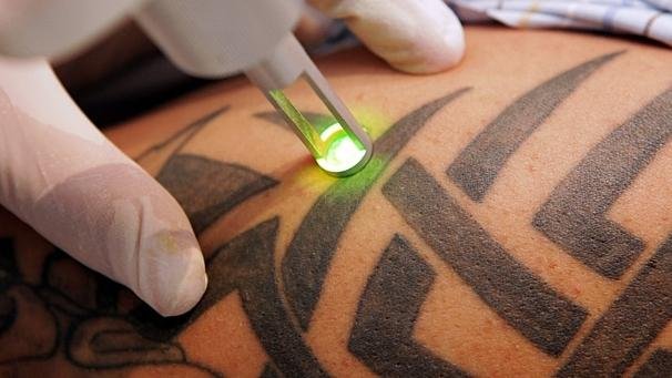 Por enquanto, o laser ainda reina absoluto