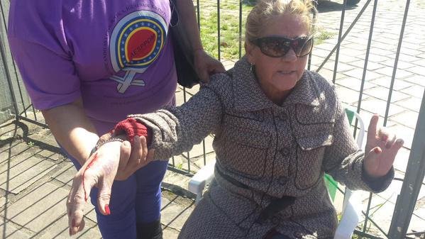 Mulher de 60 anos foi agredida em frente a canil do BOE