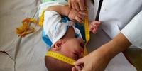 Estudo publicado na The Lancet afirma que perímetro atual submete bebês a exames desnecessários