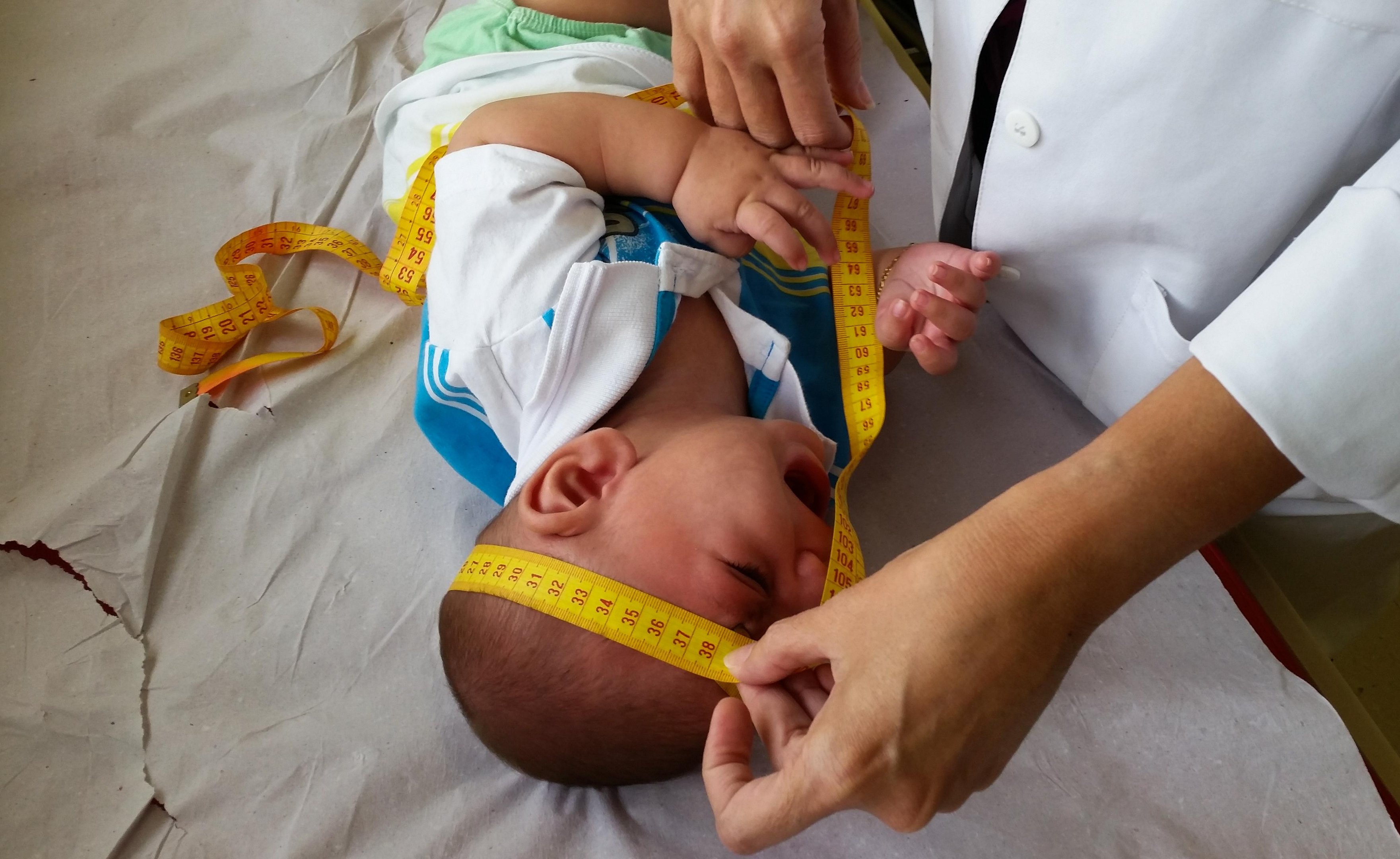 Estudo publicado na The Lancet afirma que per&iacute;metro atual submete beb&ecirc;s a exames desnecess&aacute;rios