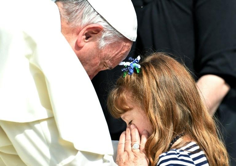 Papa aben&ccedil;oou olhos de menina com transtorno visual