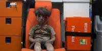 Imagem de criança ferida após ataque em Aleppo choca o mundo 