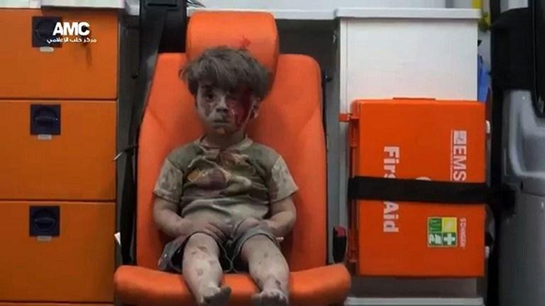 Imagem de crian&ccedil;a ferida ap&oacute;s ataque em Aleppo choca o mundo 