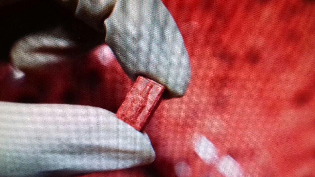 PF apreendeu 25 mil comprimidos de ecstasy em mala