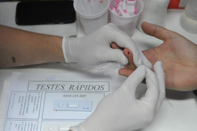 Popula&ccedil;&otilde;es vulner&aacute;veis e jovens s&atilde;o os mais suscet&iacute;veis &agrave; epidemia de Aids 