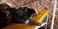 Mais de 700 pessoas morreram devido a cólera no Iêmen