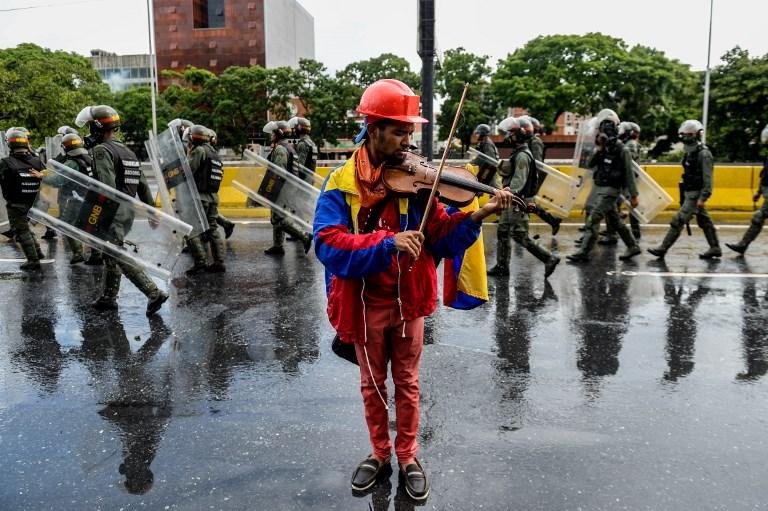 Wuilly Arteaga j&aacute; tinha sido ferido no rosto por uma bola de borracha durante manifesta&ccedil;&atilde;o
