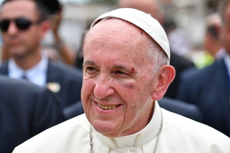 Papa Francisco termina visita &agrave; Col&ocirc;mbia com ferimento no olho ap&oacute;s queda