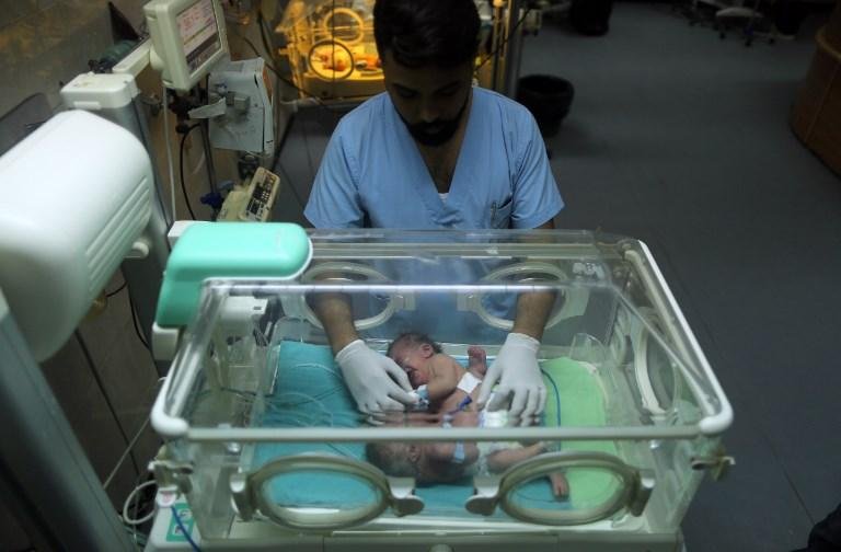 G&ecirc;meas siamesas nascem em Gaza
