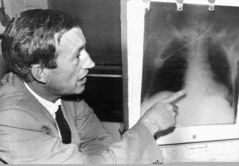 H&aacute; 50 anos primeiro transplante de cora&ccedil;&atilde;o causou sensa&ccedil;&atilde;o em todo o mundo Cidade do Cabo