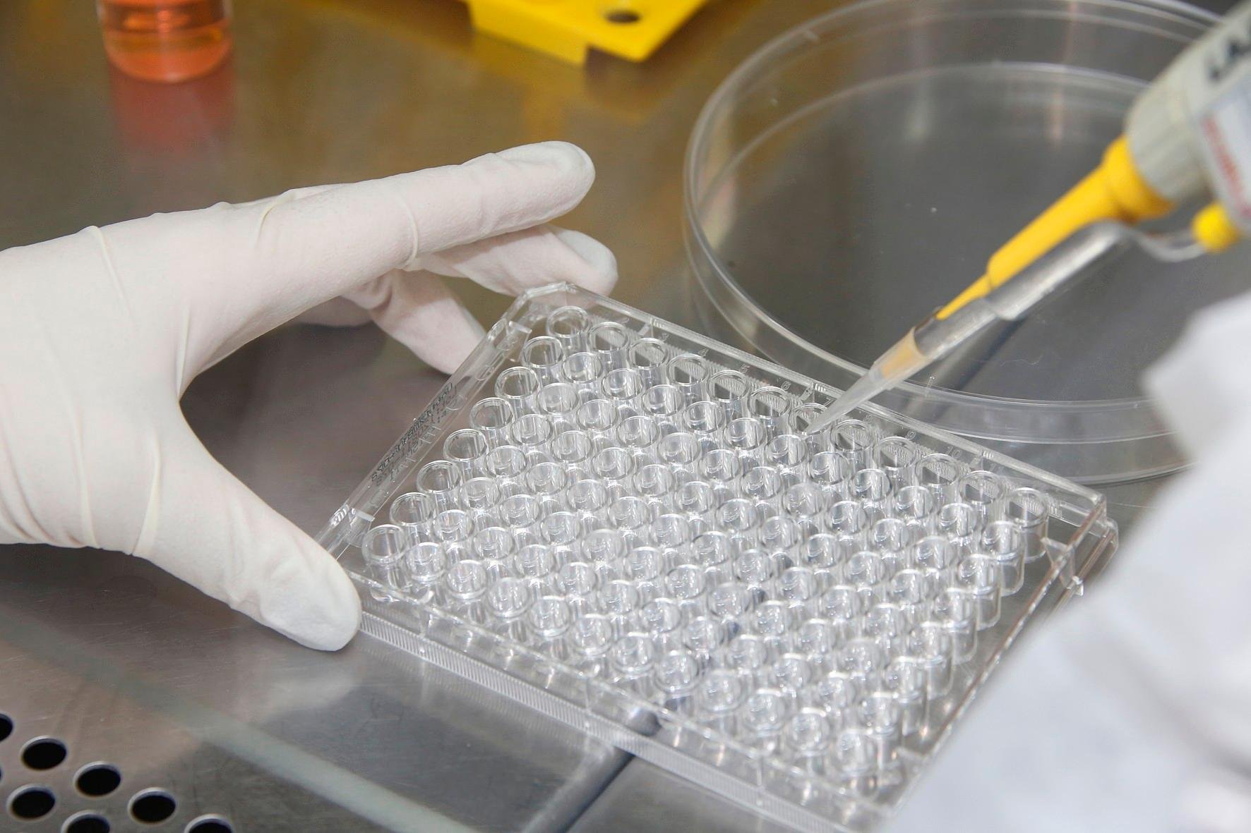 Laborat&oacute;rio japon&ecirc;s testar&aacute; detec&ccedil;&atilde;o de c&acirc;ncer com mostras de urina