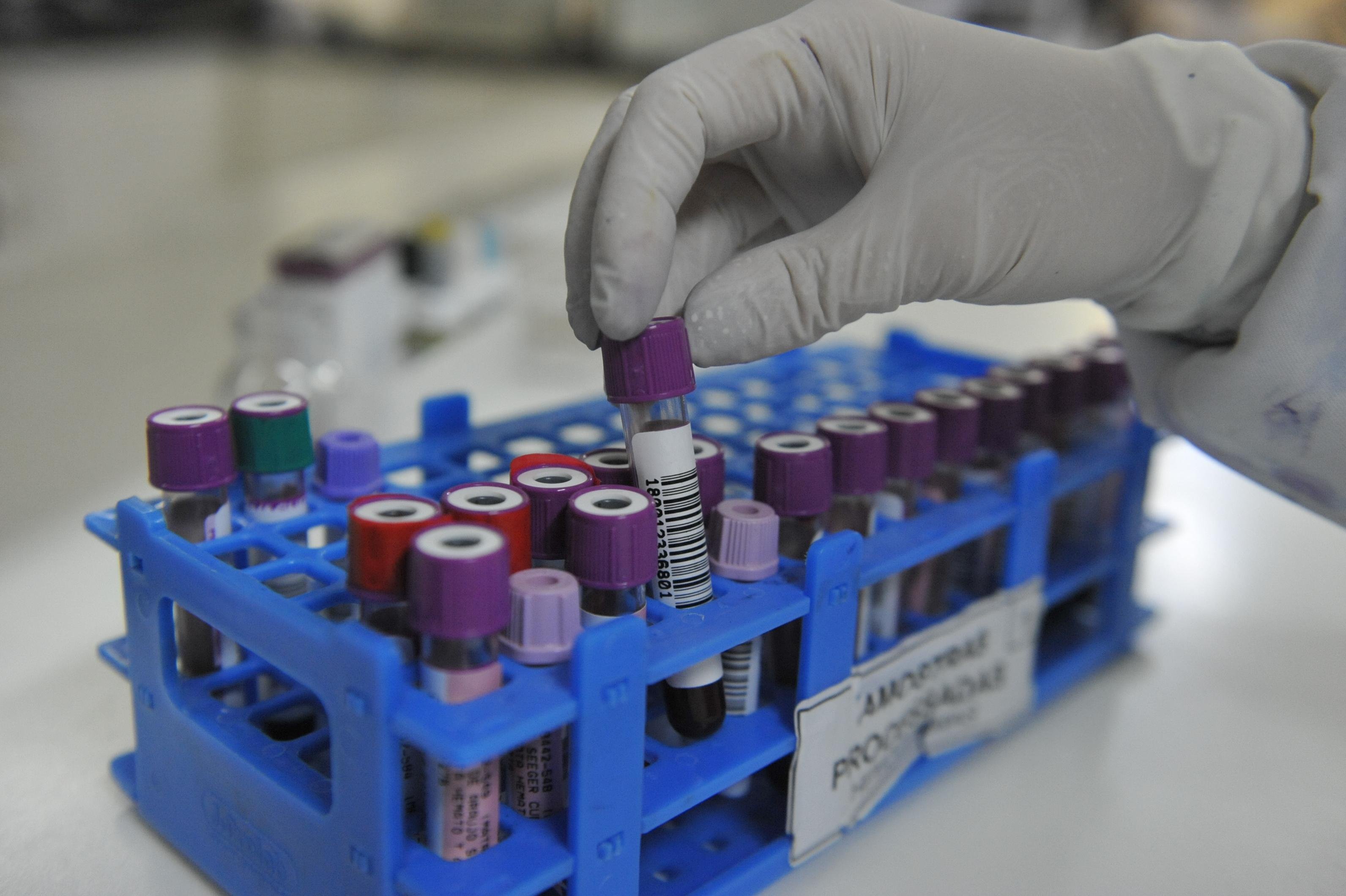 DNA do Toxoplasma gondii n&atilde;o &eacute; o mesmo dos casos confirmados da doen&ccedil;a