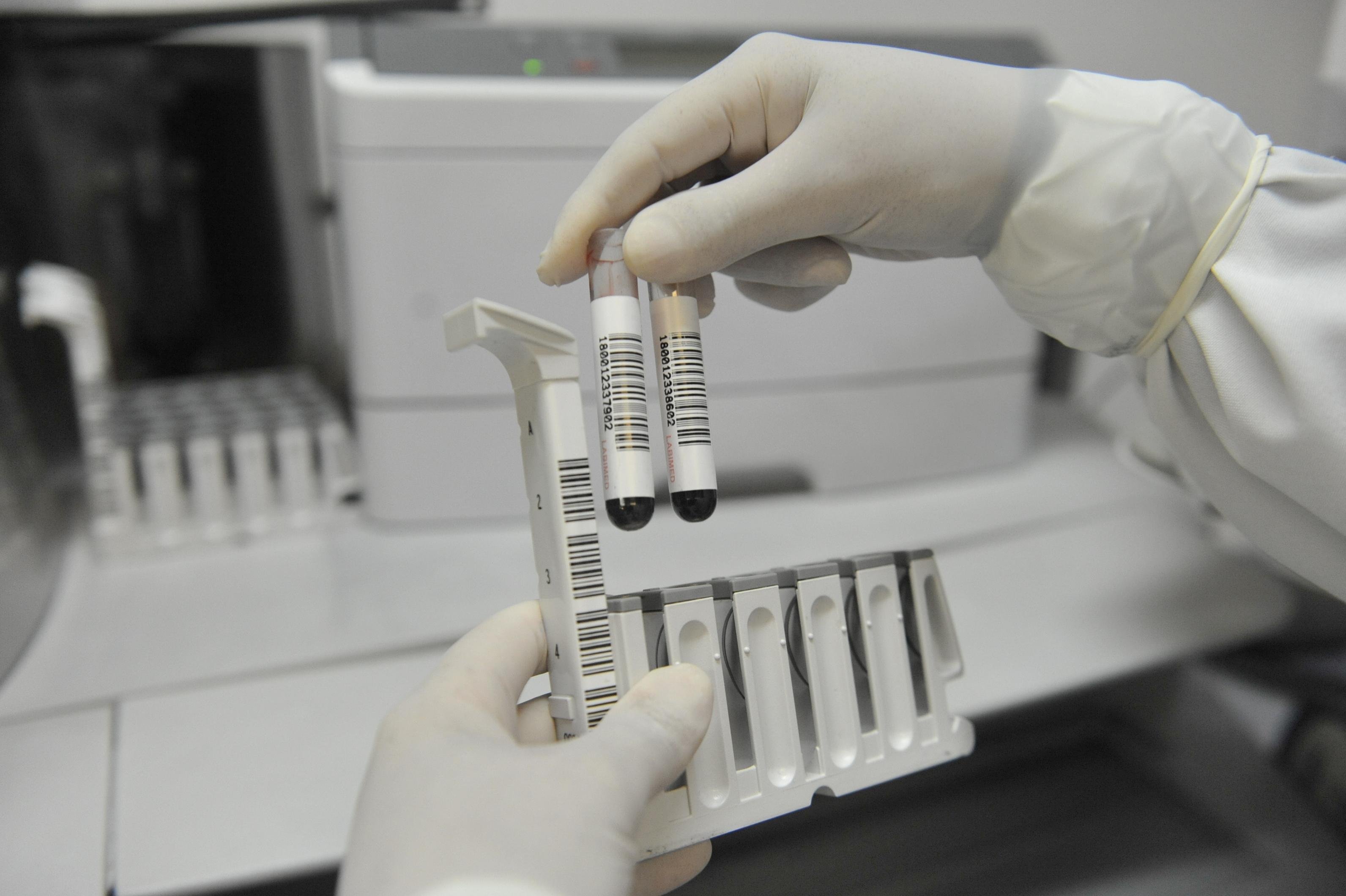Laborat&oacute;rio de Santa Maria analisa amostras de sangue