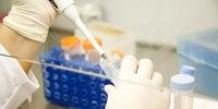 Investigações com auxílio de DNA crescem 28% no País
