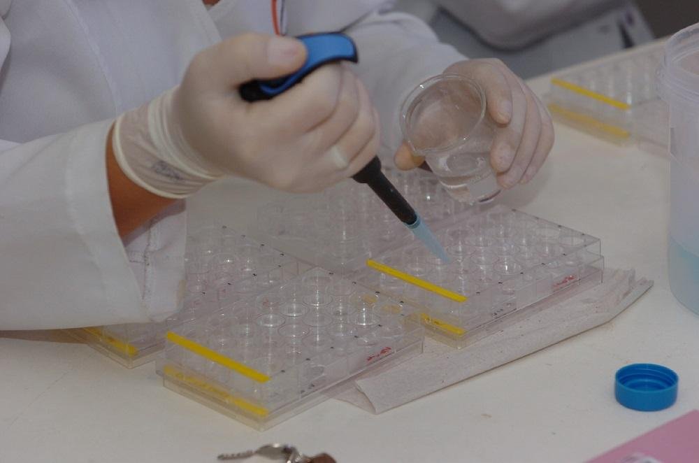 Pesquisadores transplantam c&eacute;lulas-tronco para c&eacute;rebro para tratar Parkinson
