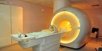 Pesquisadores aplicaram nos pacientes uma técnica particular de Imagem por Ressonância Magnética (IRM) para medir o movimento da água na substância branca do cérebro