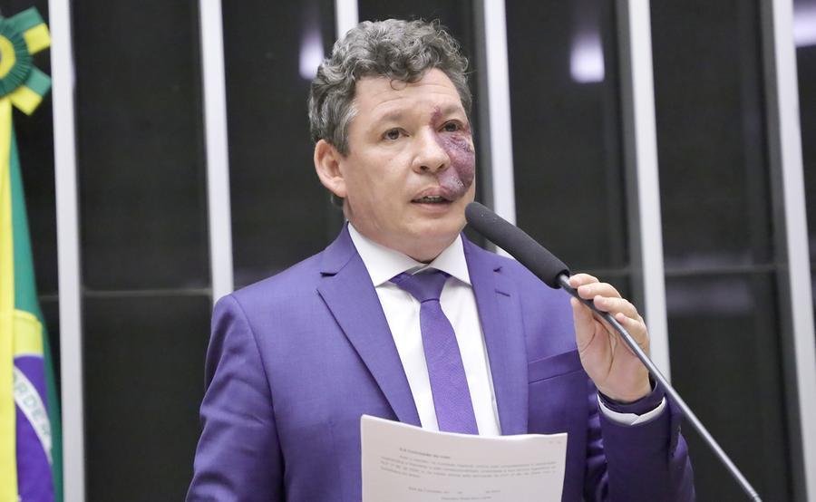 Deputado Reginaldo Lopes (PT-MG)
