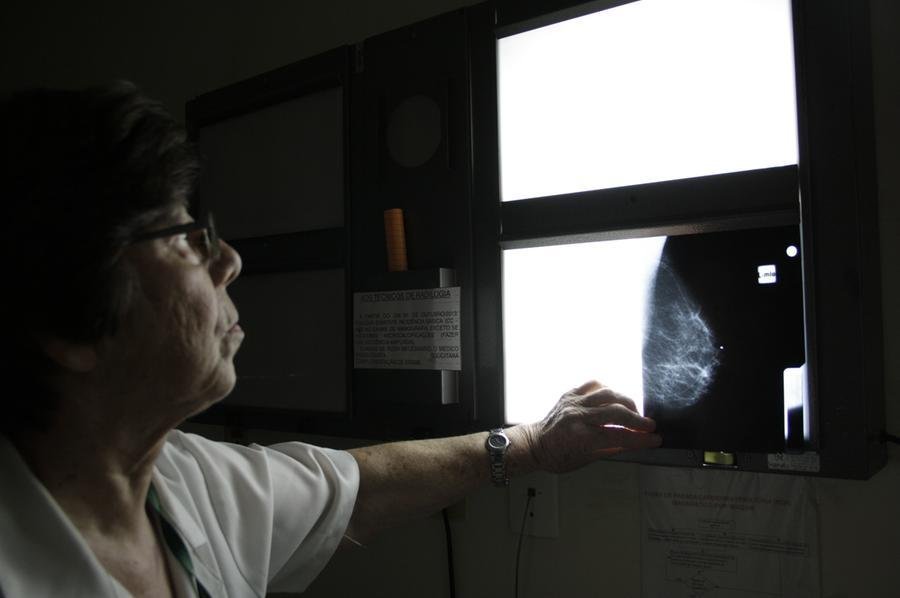 Mamografia de rastreamento deve ser realizada de dois em dois anos em mulheres de 50 a 69 anos