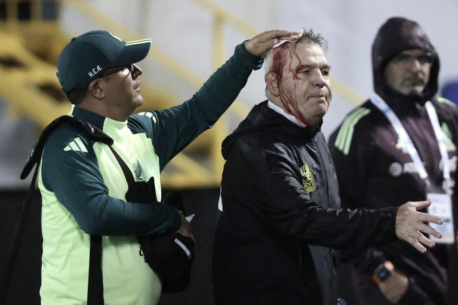 Javier Aguirre foi ferido na cabe&ccedil;a ao ser atingido por uma garrafa
