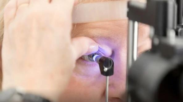 Intelig&ecirc;ncia artificial pode se tornar aliada no combate ao glaucoma