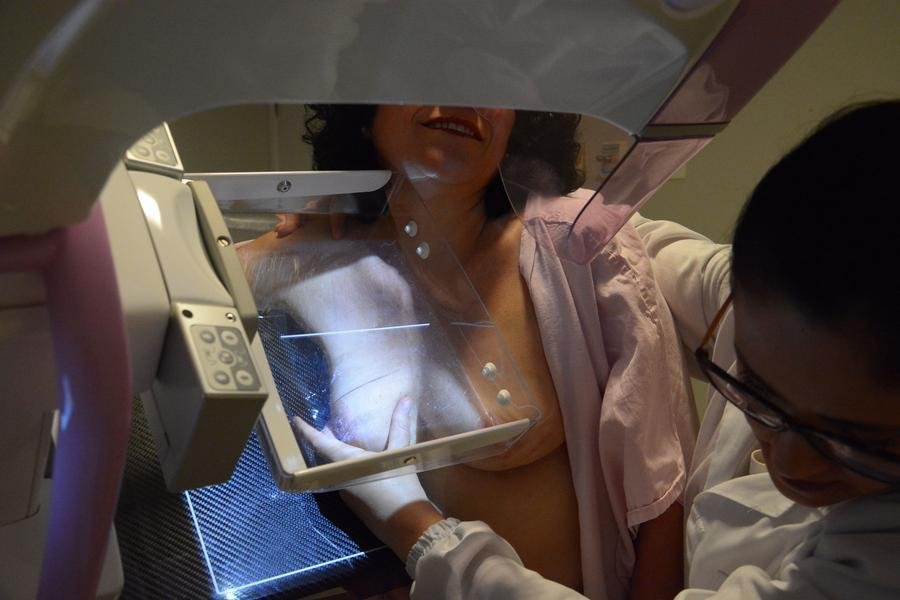 Paciente da Santa Casa de Porto Alegre, Ana Paula Couto realiza mamografia como forma de acompanhamento de seu tratamento contra o c&acirc;ncer de mama
