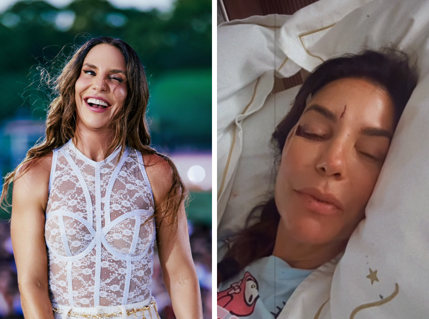 "Estou lan&ccedil;ando agora uma maquiagem diferente", brincou a cantora nos stories do Instagram, ao aparecer com curativos no rosto e com o olho roxo
