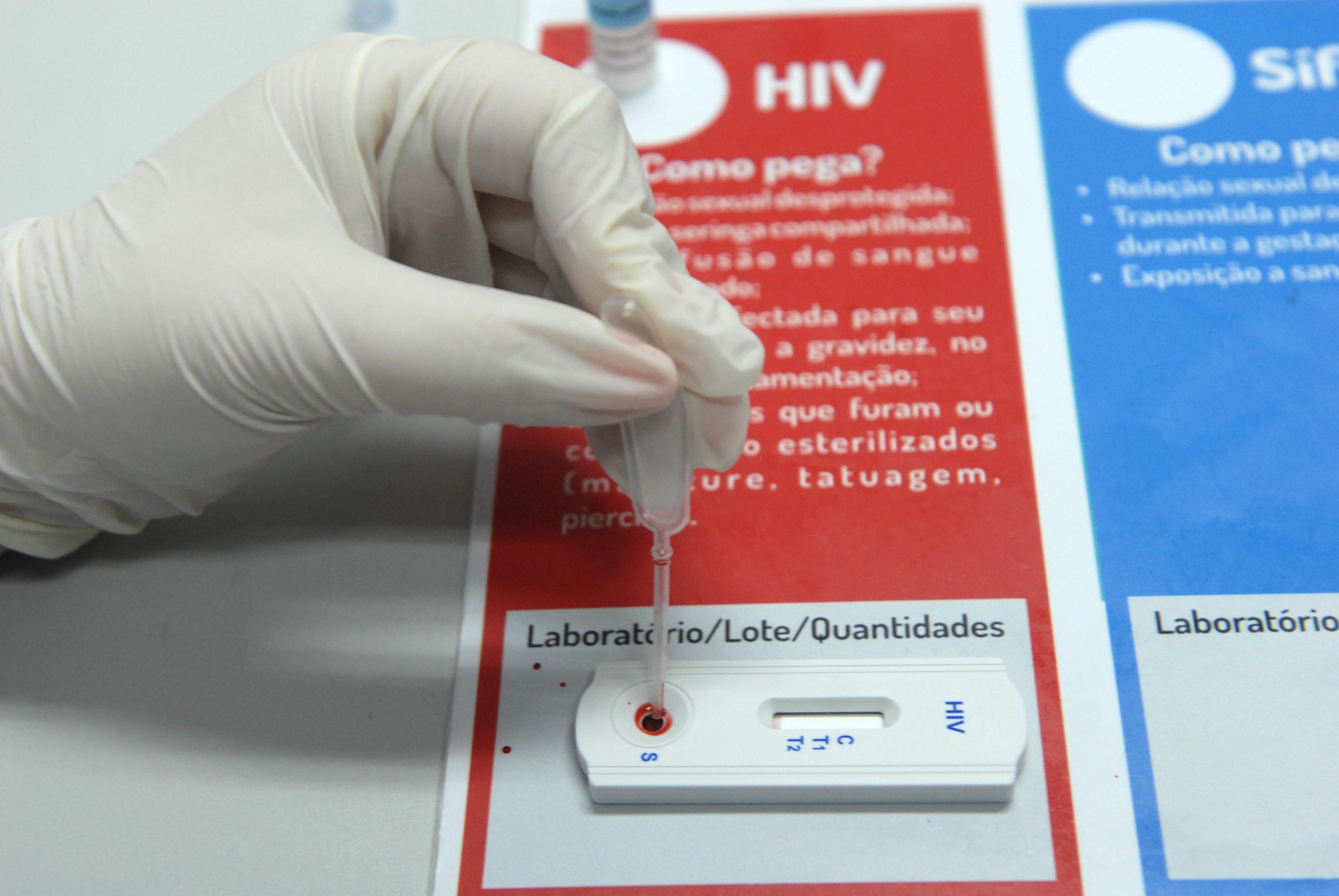 Cuidado cont&iacute;nuo &eacute; determinante para o controle do indicador