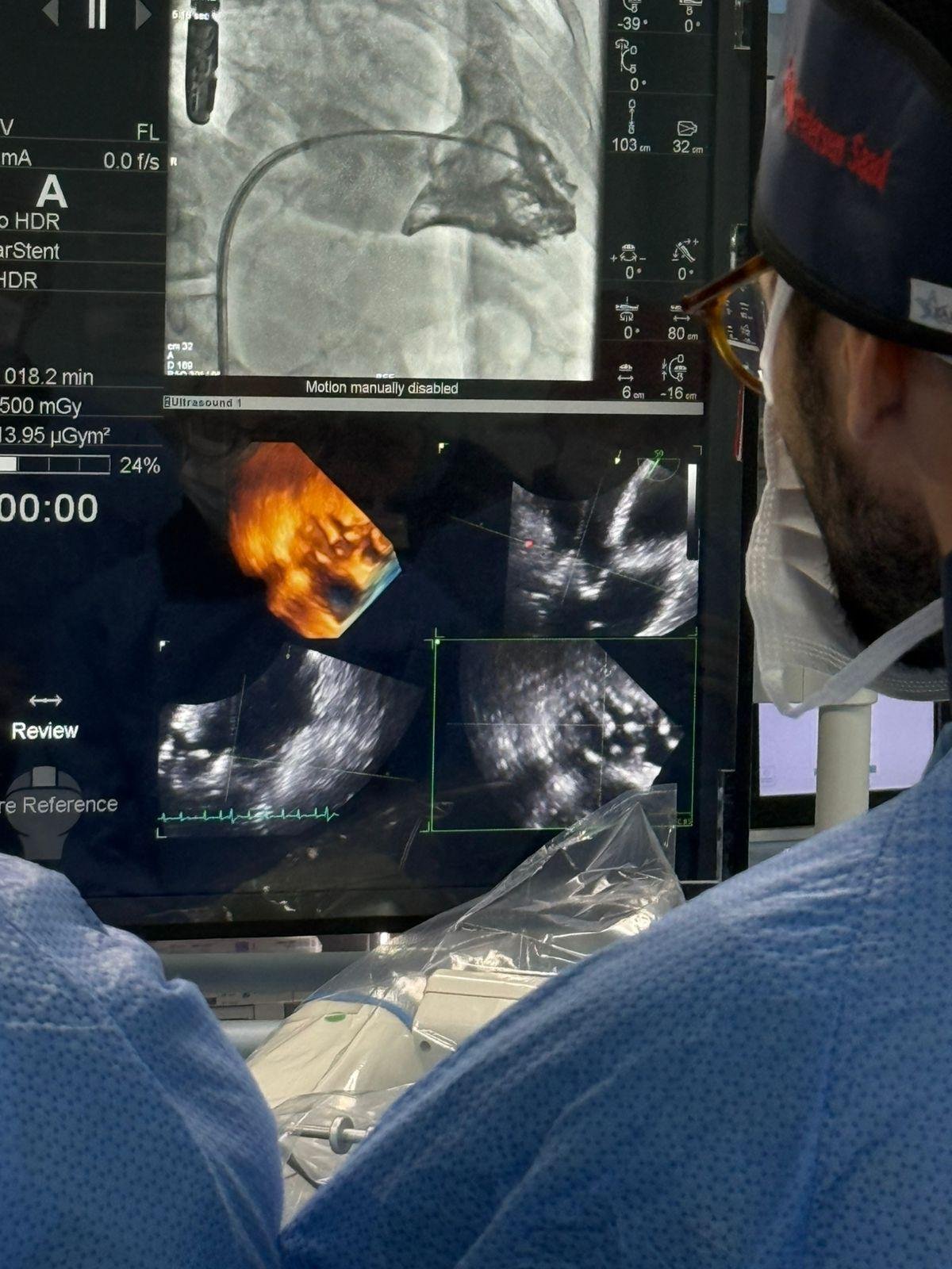 Hospital M&atilde;e de Deus realizou o segundo implante da v&aacute;lvula tric&uacute;spide Evoque da Am&eacute;rica Latina