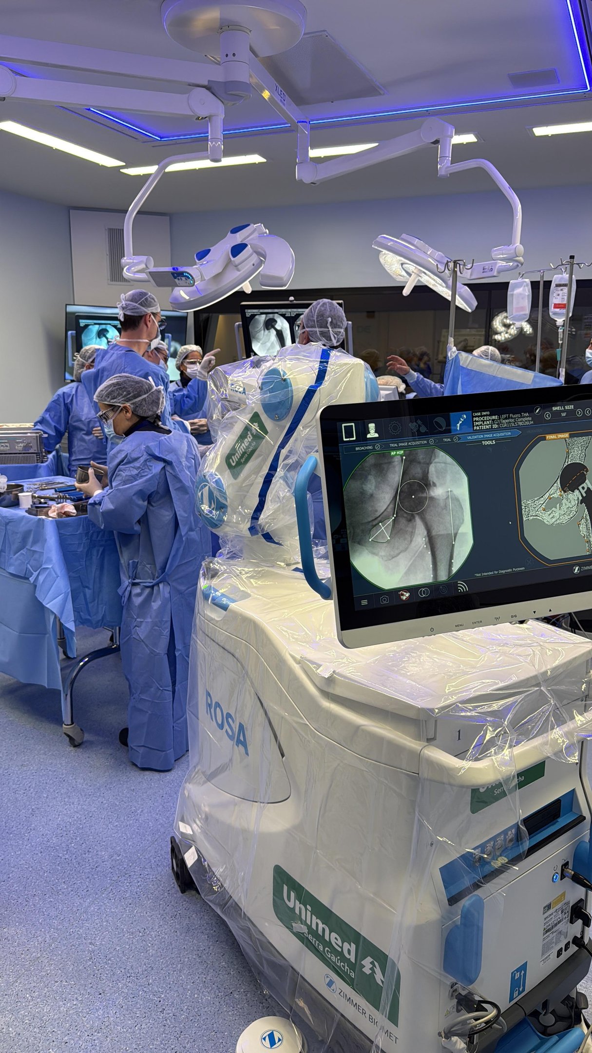 Tecnologia amplia a precis&atilde;o cir&uacute;rgica e beneficia principalmente pacientes com artrose de quadril, condi&ccedil;&atilde;o mais frequente no p&uacute;blico feminino acima dos 40 anos