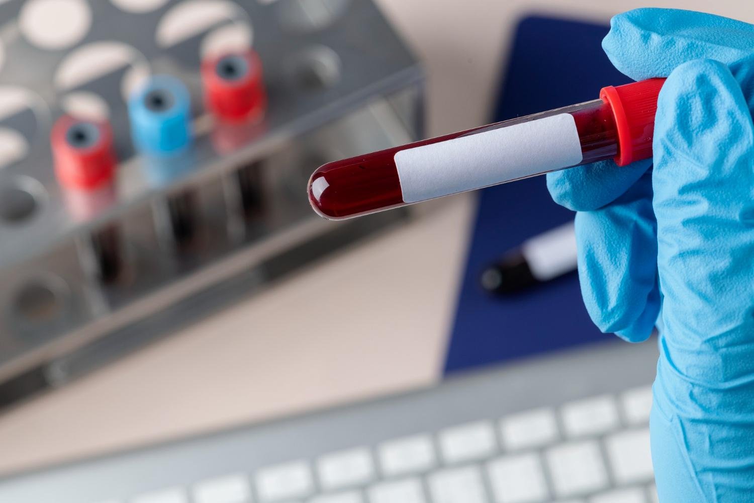 Exame de sangue capaz de detectar sinais de c&acirc;ncer antes mesmo do aparecimento dos sintomas