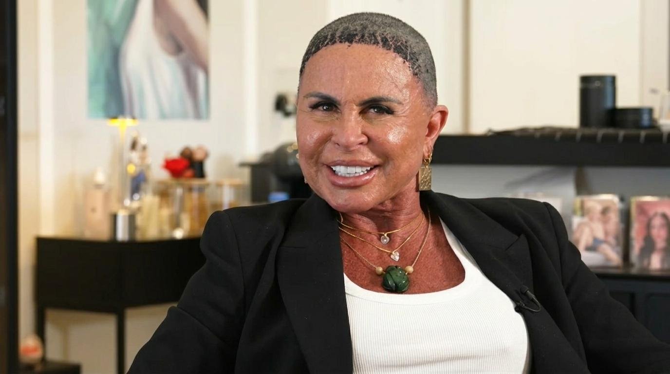 Gretchen revelou que recebe diariamente mensagens de pessoas que passaram pelo mesmo procedimento