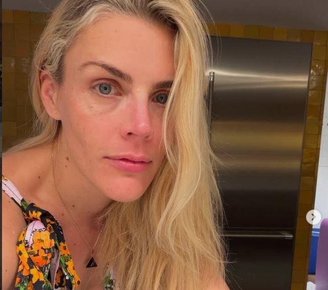 Atriz Busy Philipps conta sobre o seu tratamento