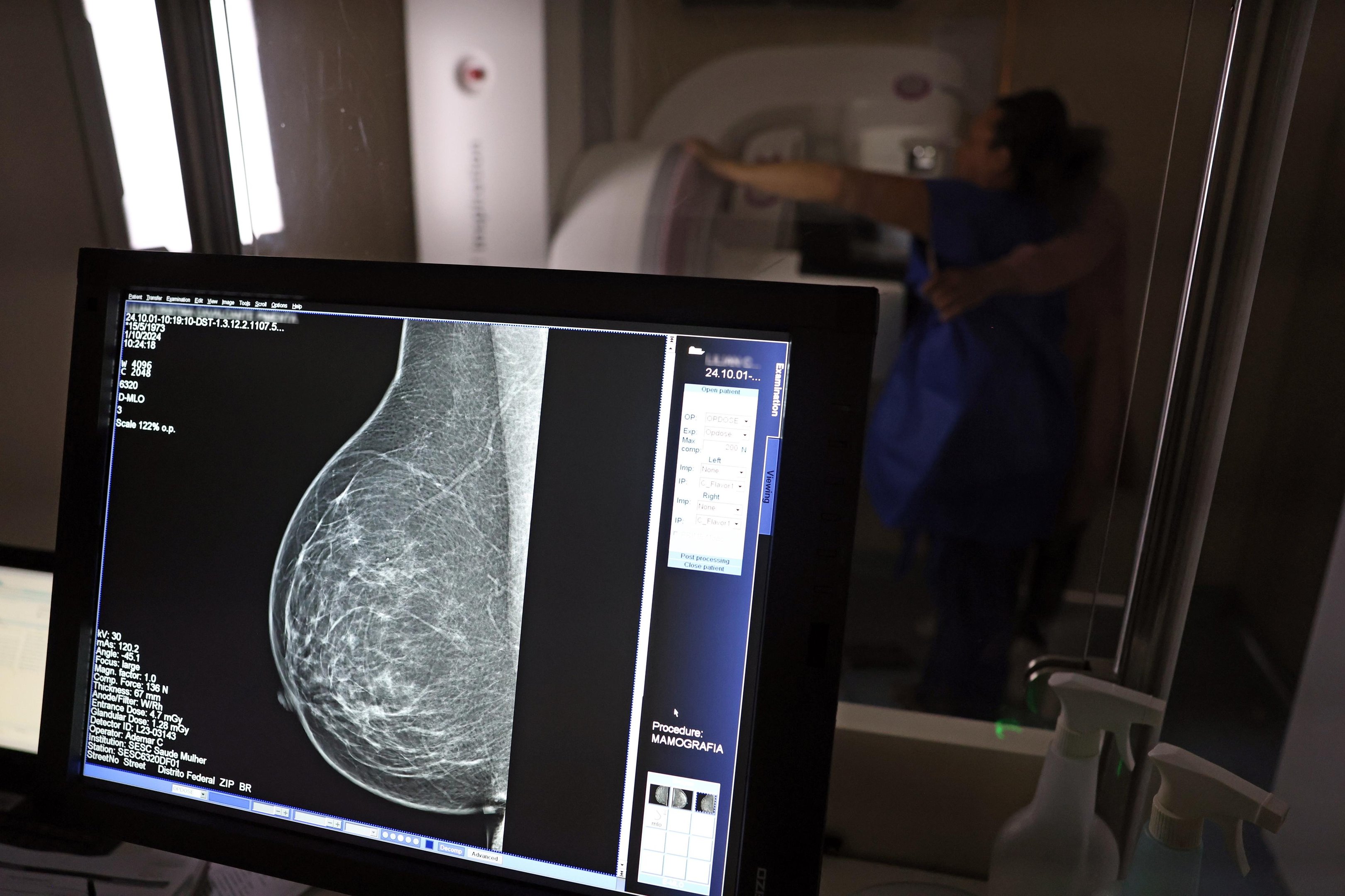 Mamografia digital,&nbsp;vers&atilde;o mais avan&ccedil;ada do exame convencional,&nbsp;&eacute; considerada um dos principais exames para a detec&ccedil;&atilde;o precoce do c&acirc;ncer de mama