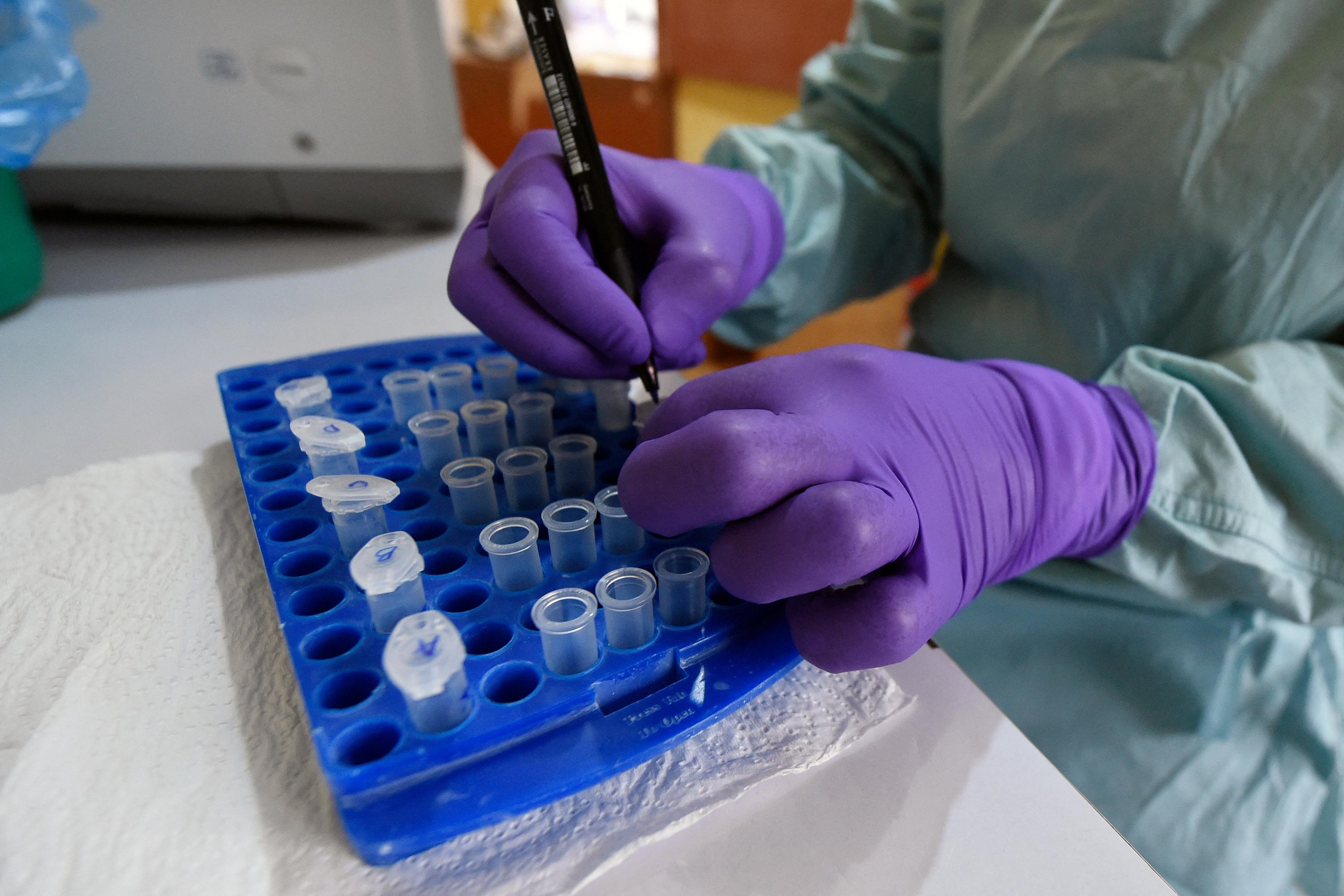 África enfrenta surto de ebola “mais complexo” após chegada do vírus à Nigéria, alerta OMS