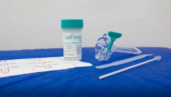 SUS detecta quase 10 mil testes positivos para HPV de alto risco