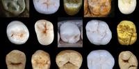 Estudo se concentrou nos molares e pré-molares de cerca de 30 fósseis do sítio de Sima de los Huesos, na Espanha