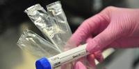 Ministério da Saúde quer distribuir testes rápidos