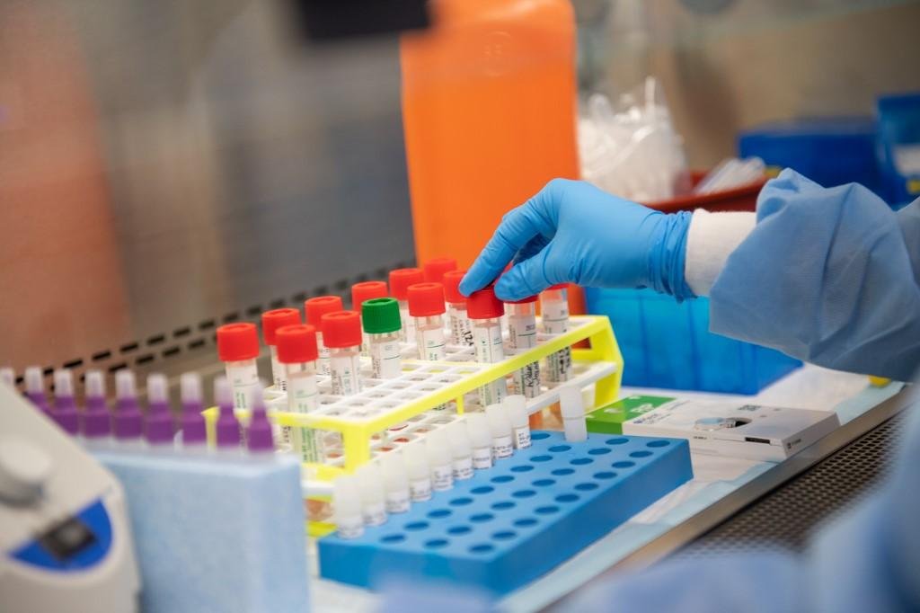 estes r&aacute;pidos prometem apresentar resultado sobre novo coronav&iacute;rus em dez minutos